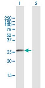 IGKV1-5 Antibody in Western Blot (WB)
