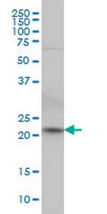 NKIRAS2 Monoclonal Antibody (2G9)