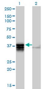 TRDD3 Polyclonal Antibody, MaxPab™
