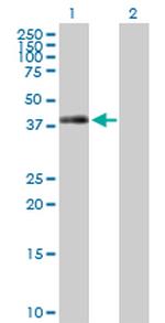 TRIB2 Polyclonal Antibody, MaxPab™