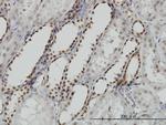 DCPS Antibody in Immunohistochemistry (Paraffin) (IHC (P))