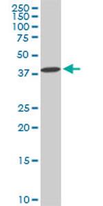 DCPS Antibody in Western Blot (WB)