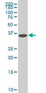 DCPS Antibody in Western Blot (WB)