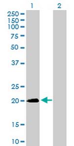 SNX24 Antibody in Western Blot (WB)