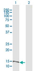 MRPL42 Antibody in Western Blot (WB)