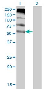 FLVCR Monoclonal Antibody (4B2)