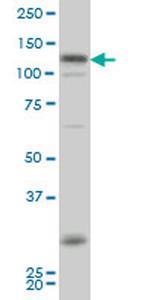 HIPK2 Antibody in Western Blot (WB)