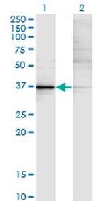 KLF15 Antibody in Western Blot (WB)
