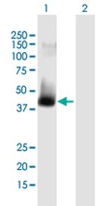 ATAD2 Antibody in Western Blot (WB)