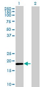 ZC3H7A Antibody in Western Blot (WB)