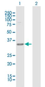 C1GALT1C1 Polyclonal Antibody, MaxPab™