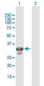 CHMP4A Polyclonal Antibody, MaxPab™