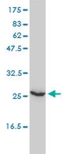 UBE2T Antibody in Western Blot (WB)