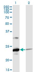 UBE2T Monoclonal Antibody (4G1-4C2)