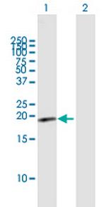 HSPC159 Polyclonal Antibody, MaxPab™