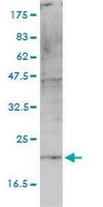 HSPC163 Antibody in Western Blot (WB)