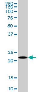 HEMK2 Antibody in Western Blot (WB)