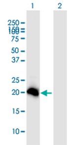 HEMK2 Polyclonal Antibody, MaxPab™