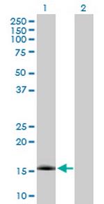 NXT1 Antibody in Western Blot (WB)