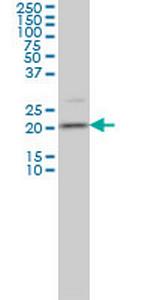 TAGLN3 Monoclonal Antibody (1D2)