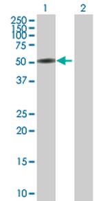 CTNNA3 Polyclonal Antibody, MaxPab™