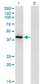 TMOD3 Monoclonal Antibody (1E1)