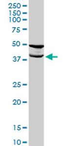 TMOD2 Antibody in Western Blot (WB)