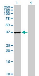 ABT1 Antibody in Western Blot (WB)
