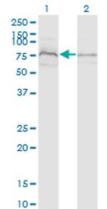 ZDHHC8 Antibody in Western Blot (WB)