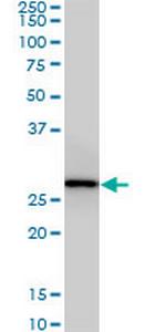 CNOT7 Antibody in Western Blot (WB)