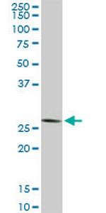 CNOT7 Antibody in Western Blot (WB)