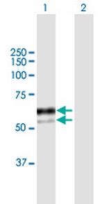 SNX8 Antibody in Western Blot (WB)