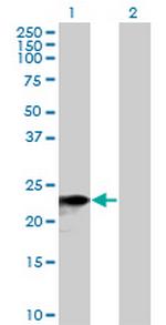SNX10 Polyclonal Antibody, MaxPab™