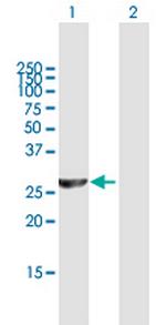 PSMC3IP Polyclonal Antibody, MaxPab™
