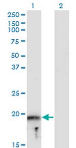 MYLPF Monoclonal Antibody (3H3)