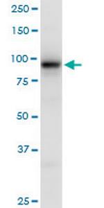 EEF2K Polyclonal Antibody, MaxPab™