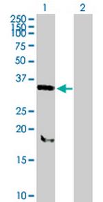 SNX11 Polyclonal Antibody, MaxPab™