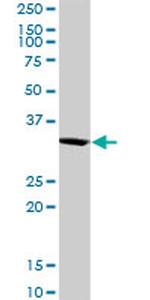 SNX11 Antibody in Western Blot (WB)