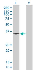 SNX11 Polyclonal Antibody, MaxPab™