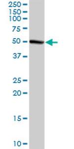 GMPPA Antibody in Western Blot (WB)