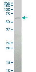ALG6 Monoclonal Antibody (2G11)