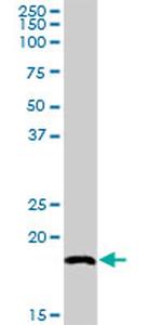 SNX12 Antibody in Western Blot (WB)