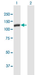DSE Polyclonal Antibody, MaxPab™