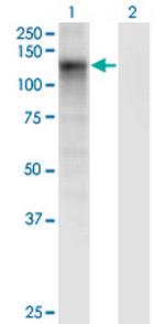 DSE Monoclonal Antibody (6D4)