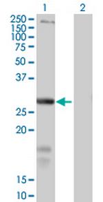 SLC39A3 Polyclonal Antibody, MaxPab™