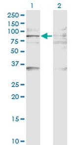 BAZ2B Monoclonal Antibody (2D10)