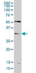 TLX3 Monoclonal Antibody (2A3)