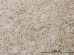 RAX Antibody in Immunohistochemistry (Paraffin) (IHC (P))