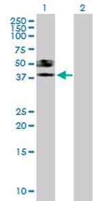 ST6GALNAC6 Polyclonal Antibody, MaxPab™