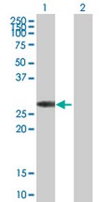 KCNIP3 Antibody in Western Blot (WB)